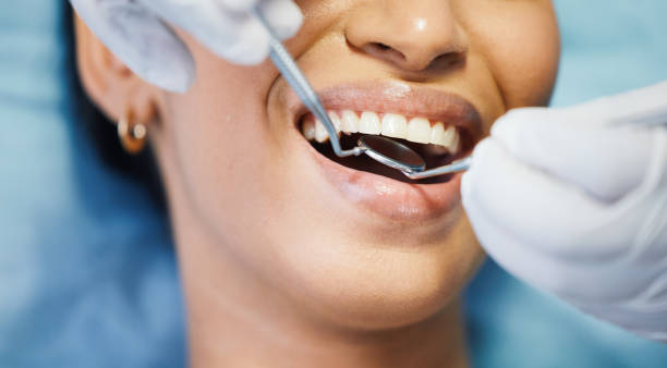 Best Emergency Gum Treatment in Maud, TX
